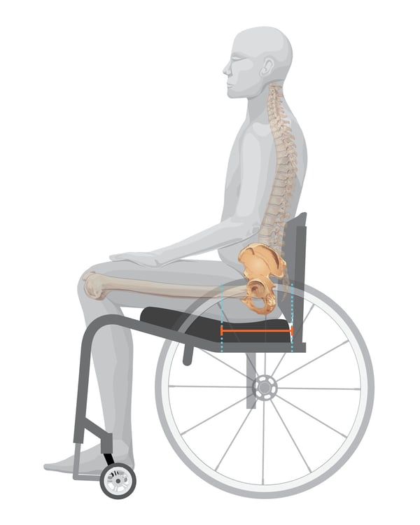 K0005 Configuration Seat Slope and Ergo Seat